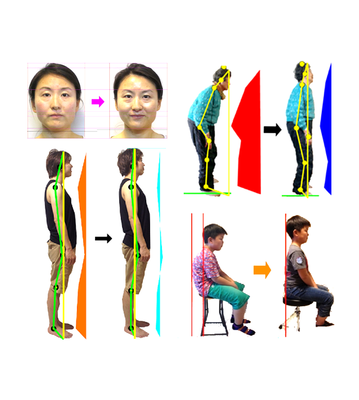 村田雅史カイロプラクターによるやさしい施術の様子